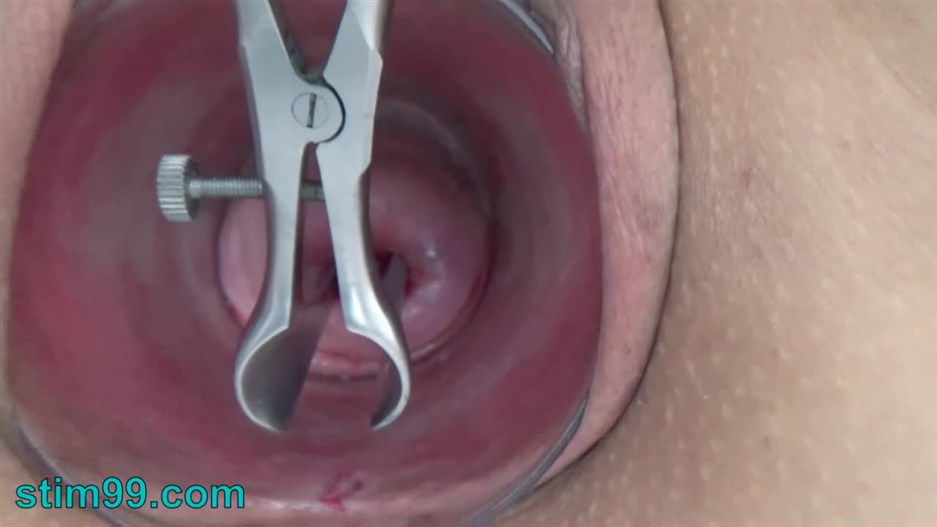 Stim99 – Open Cervix with Speculum and Semen Insertion in Uterus - pornevening.com